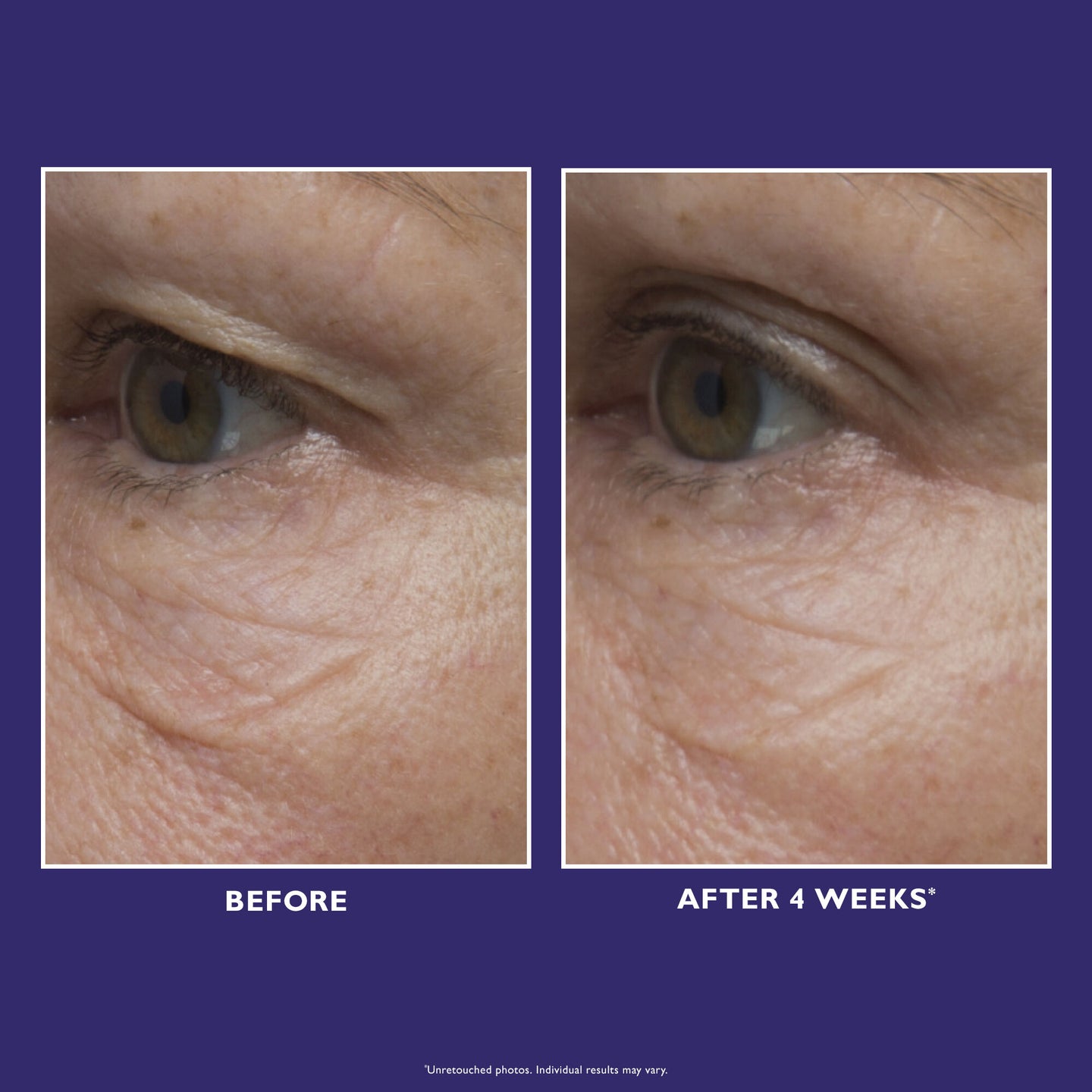 Ultimate Solution 5 Multitasking Eye Cream|15 ml / 0.5 fl oz